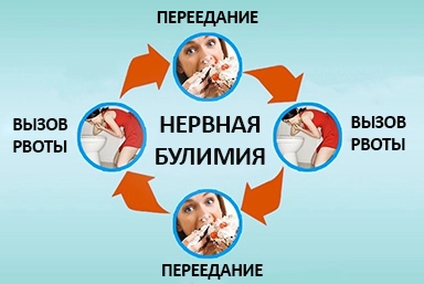 Лечение булимии в Микуни